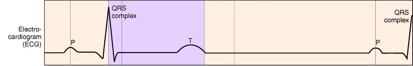 hier fehlt das Ekg-Bild