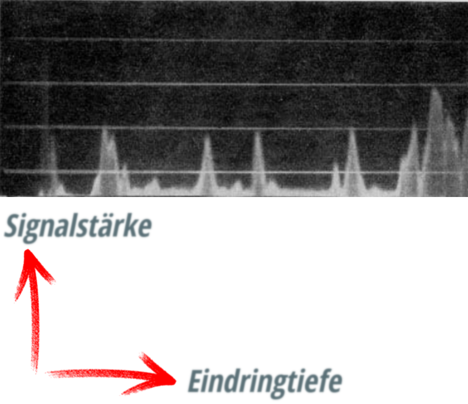 Edler-Echokardiographie