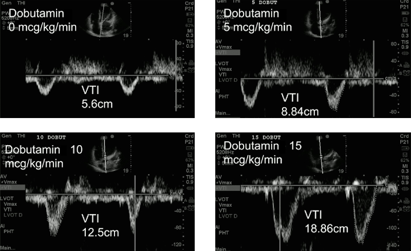Therapiesteuerung_VTI